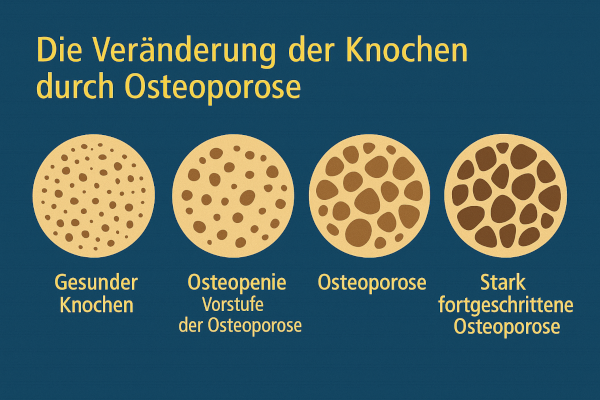 Illustration der Knochenstruktur